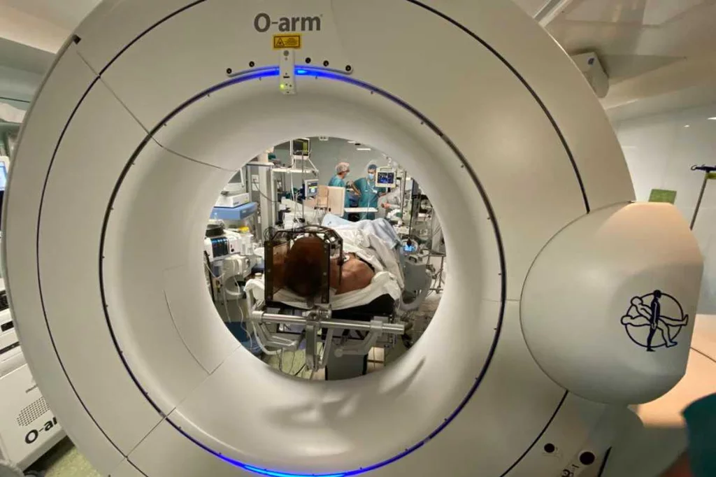 Un paciente es sometido a neurocirugía para implantarle el dispositivo de estimulación cerebral profunda. Foto: HOSPITAL CLÍNIC.