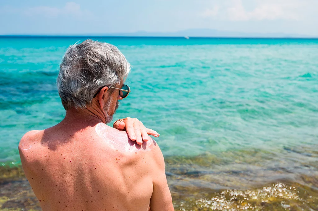 Se estima que la prevalencia de la queratosis actÃnica es del 28,6% en la poblaciÃ³n espaÃ±ola de mÃ¡s de 45 aÃ±os. Foto: SHUTTERSTOCK.