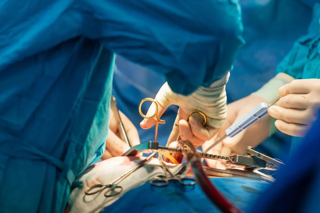 Trasplante de corazÃ³n. Foto: SHUTTERSTOCK.