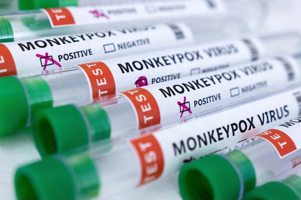 Tubos de ensayo etiquetados con resultados positivos de Mpox. Foto: REUTERS.