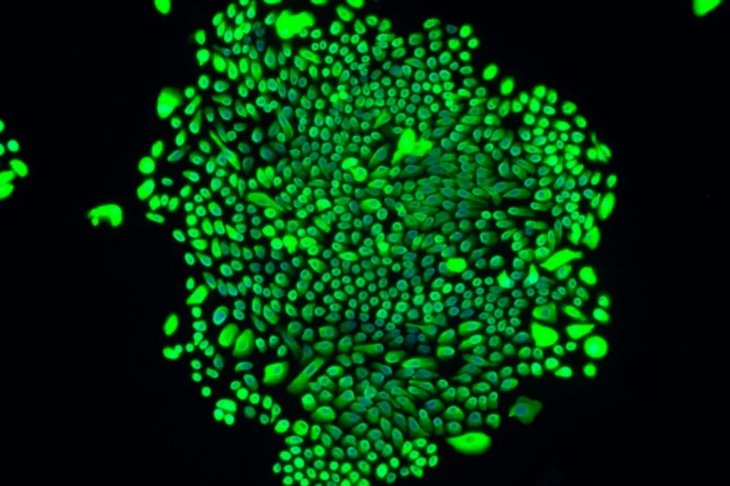 Células pulmonares progenitoras P63+. Foto: WEI ZOU