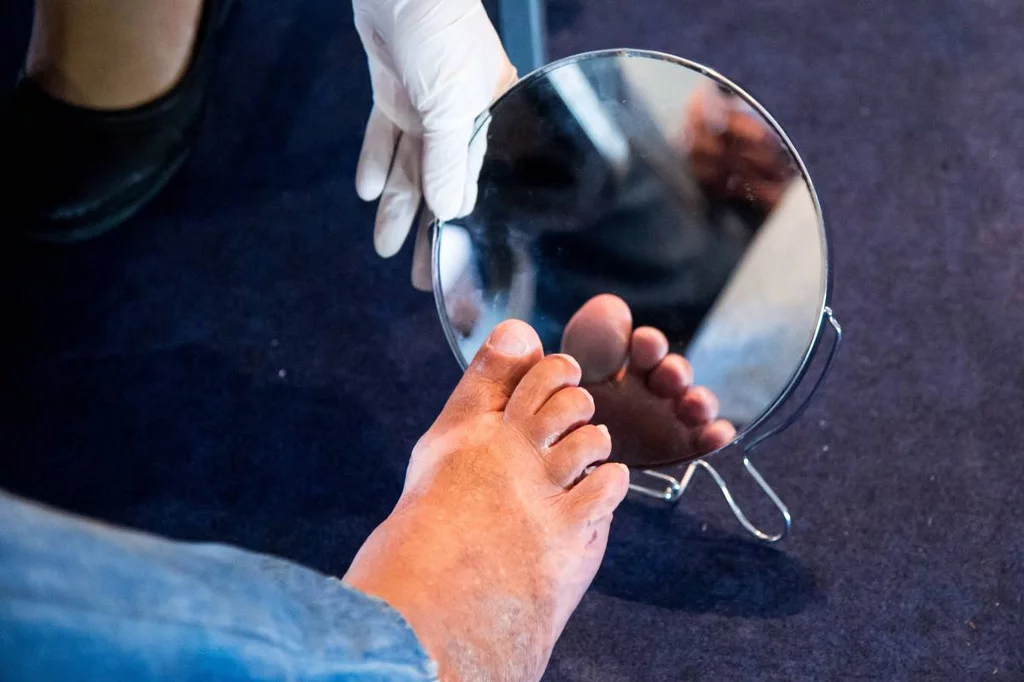 La autoexploraciÃ³n del pie en busca de lesiones es un hÃ¡bito imprescindible de la persona con diabetes. Foto: SHUTTERSTOCK.