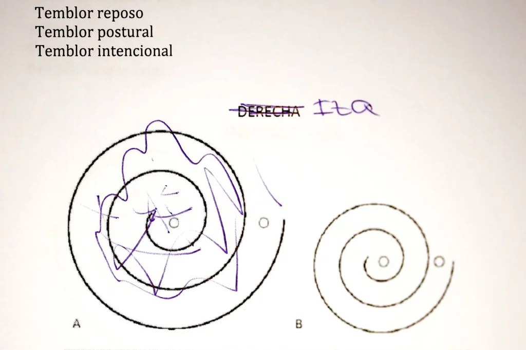 Prueba realizada por un paciente con un trastorno del movimiento. Imagen: ALBERTO DI LOLLI.