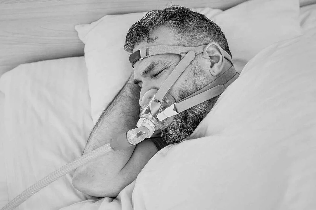 La CPAP para el tratamiento de la apnea del sueÃ±o sÃ reduce el riesgo de volver a sufrir episodios cardiovasculares y cerebrovasculares. Foto: SHUTTERSTOCK
