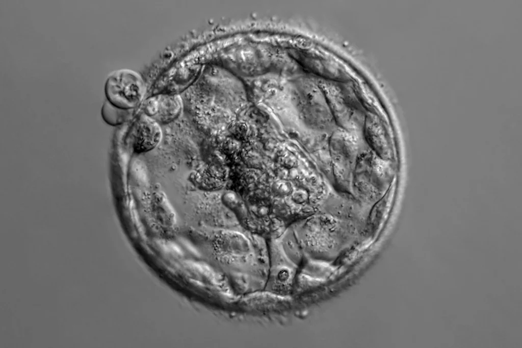 Fotomicrografía de un embrión humano aislado en fase blastocista. Foto: SHUTTERSTOCK.