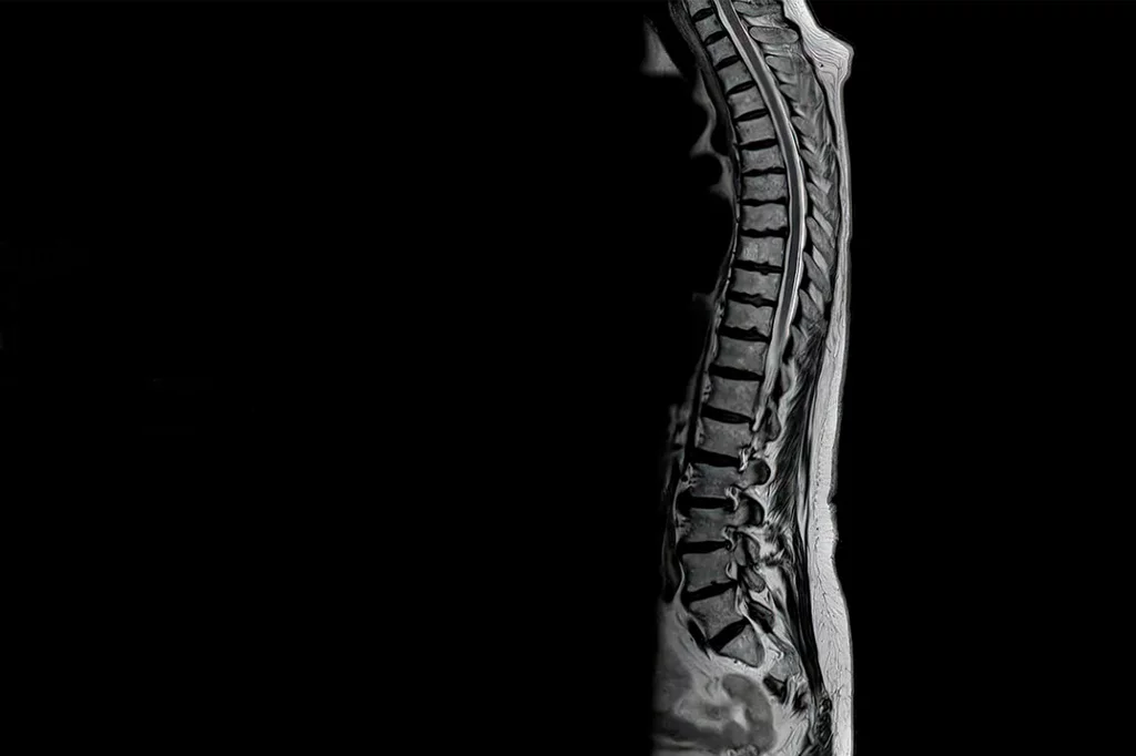 Corte sagital de la espina dorsal completa, obtenida solo en un minuto y 22 segundos. Foto: SIEMENS HEALTHINEERS