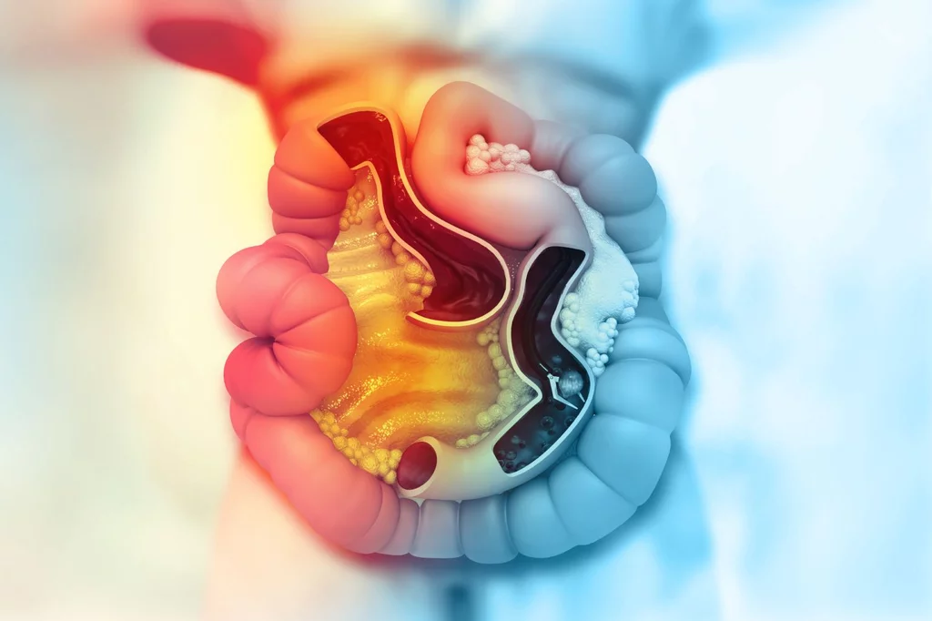 El cáncer colorrectal tiene una elevada resolución si se detecta de forma temprana. Foto: SHUTTERSTOCK. 