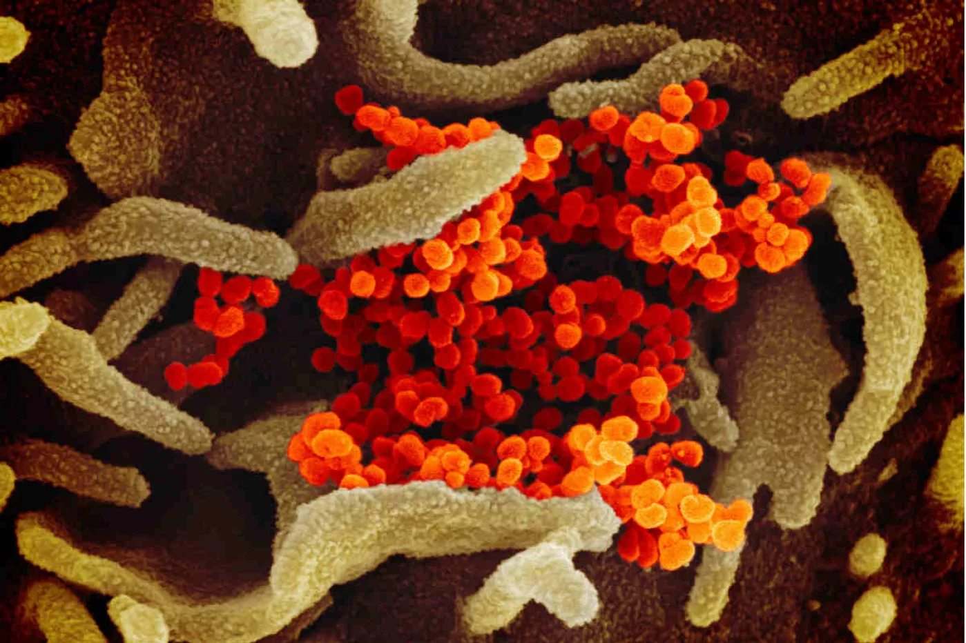 El SARS-CoV-2 emergiendo de una célula infectada