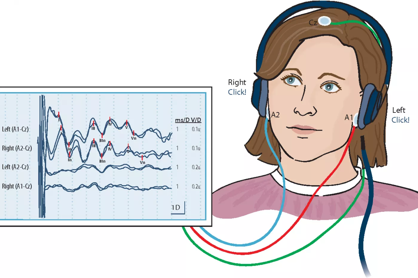 Potenciales evocados DiarioMedico