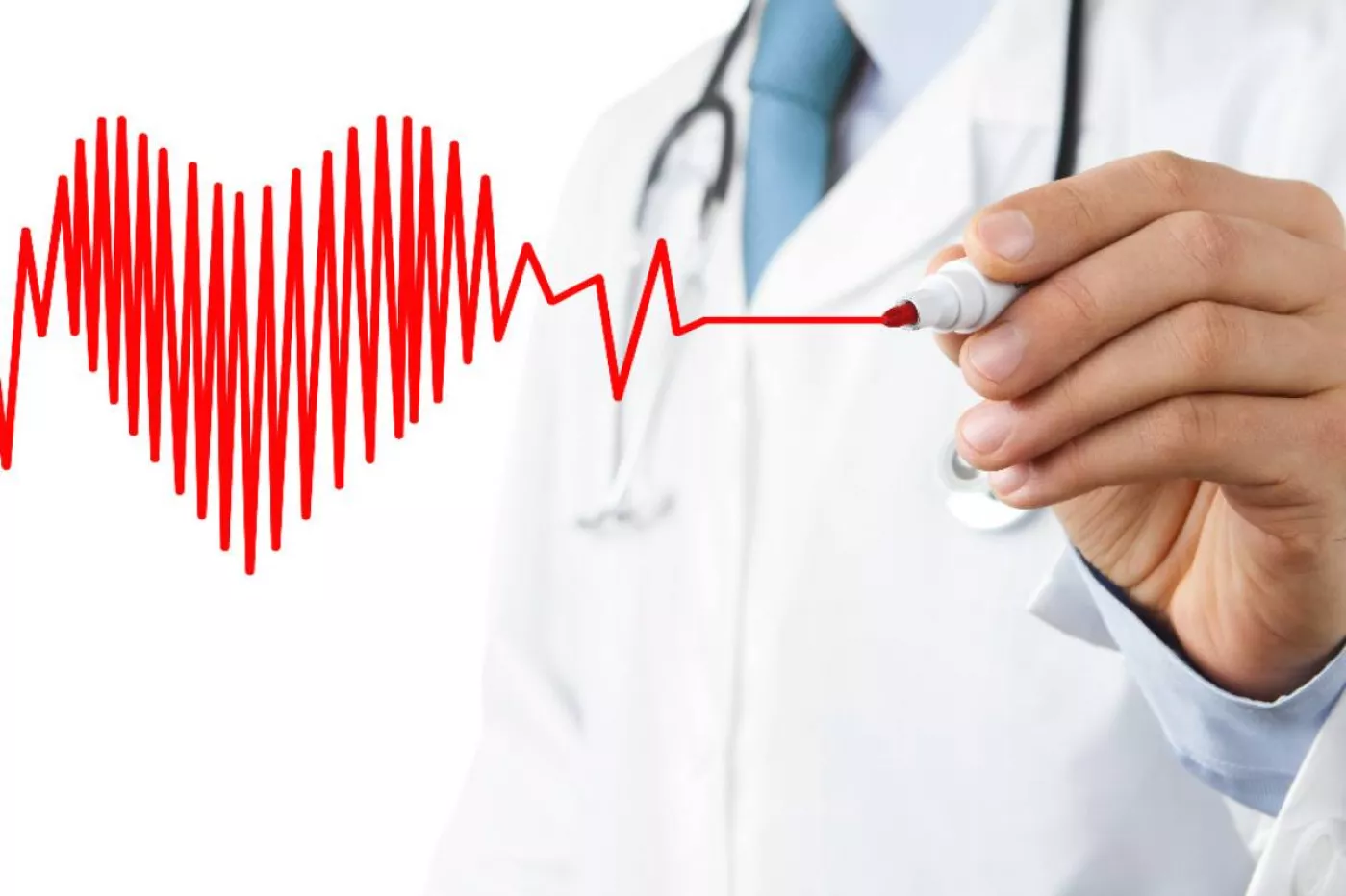 La toxicidad cardiaca es un efecto adverso conocido de la hidroxicloroquina y la cloroquina.
