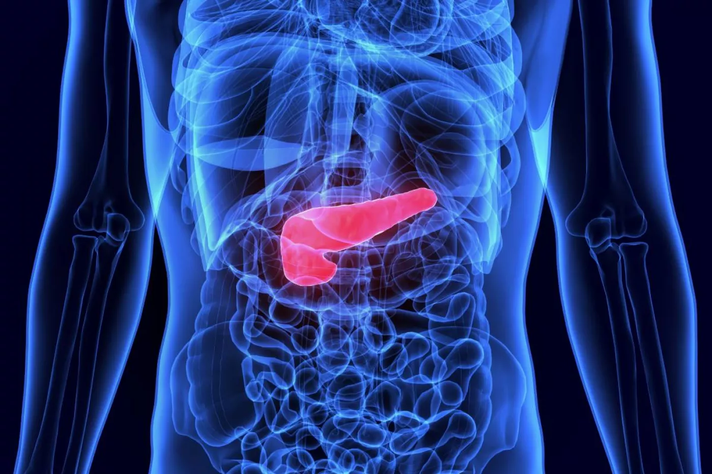 La mortalidad en cáncer de páncreas se sitúa en torno al 95% en menos de 12 meses