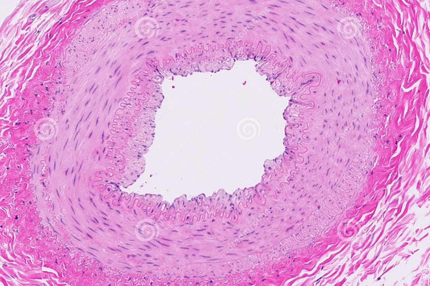 arteria renal