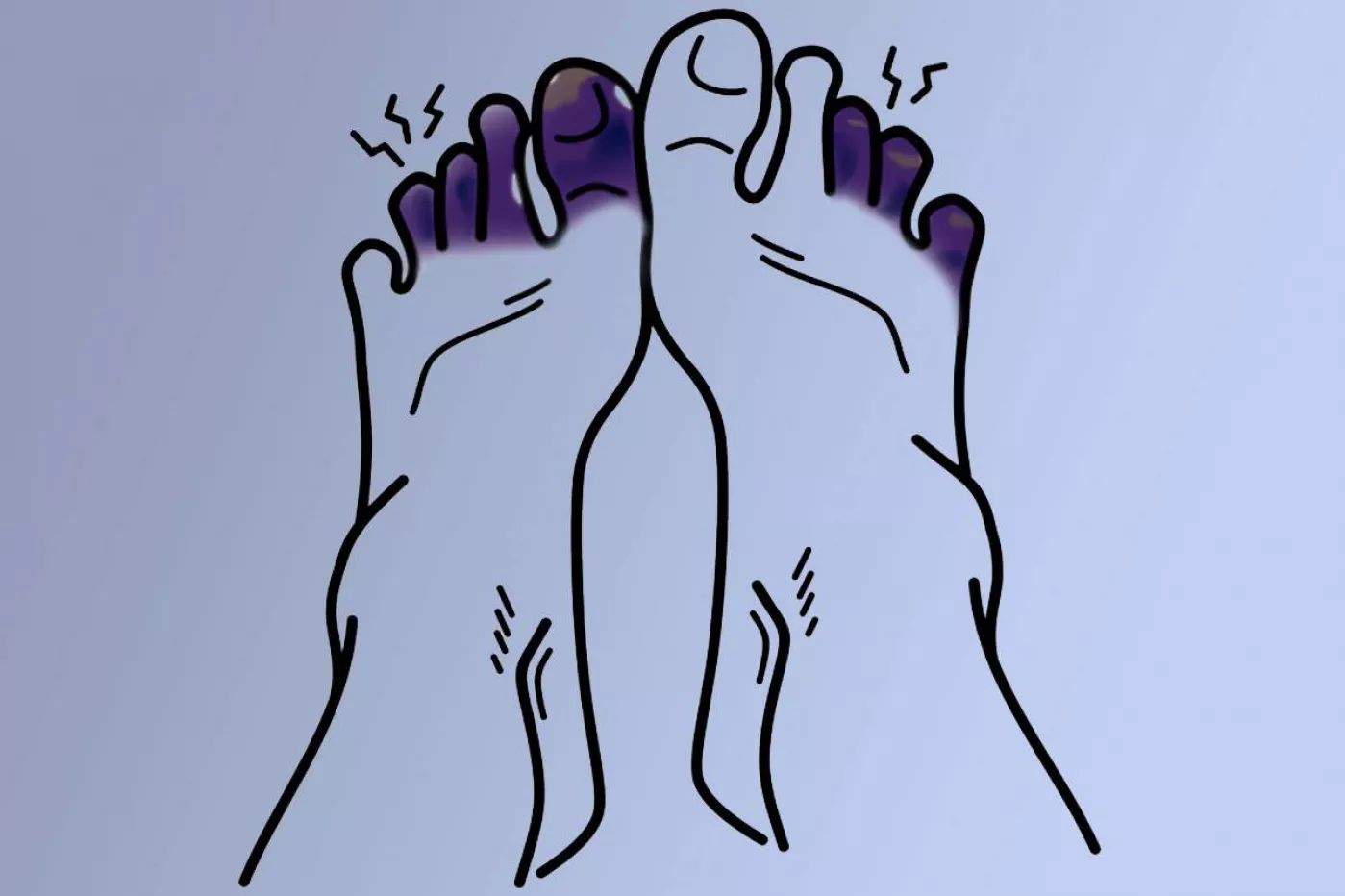 Imagen de unos dedos del pie con necrosis. 
