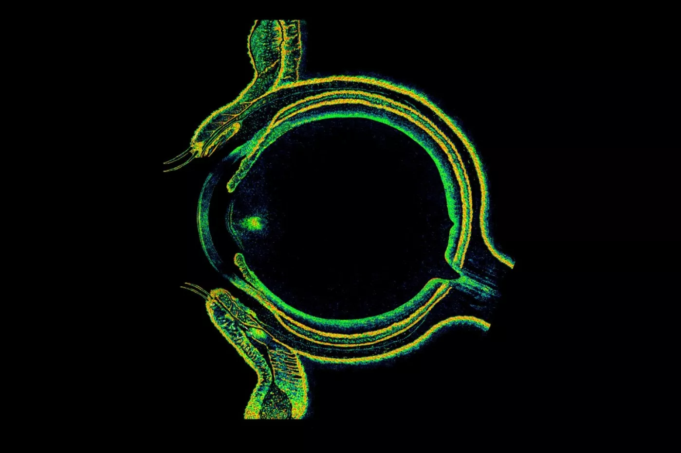 Montaje de OCT que muestra la sección transversal de un ojo humano.