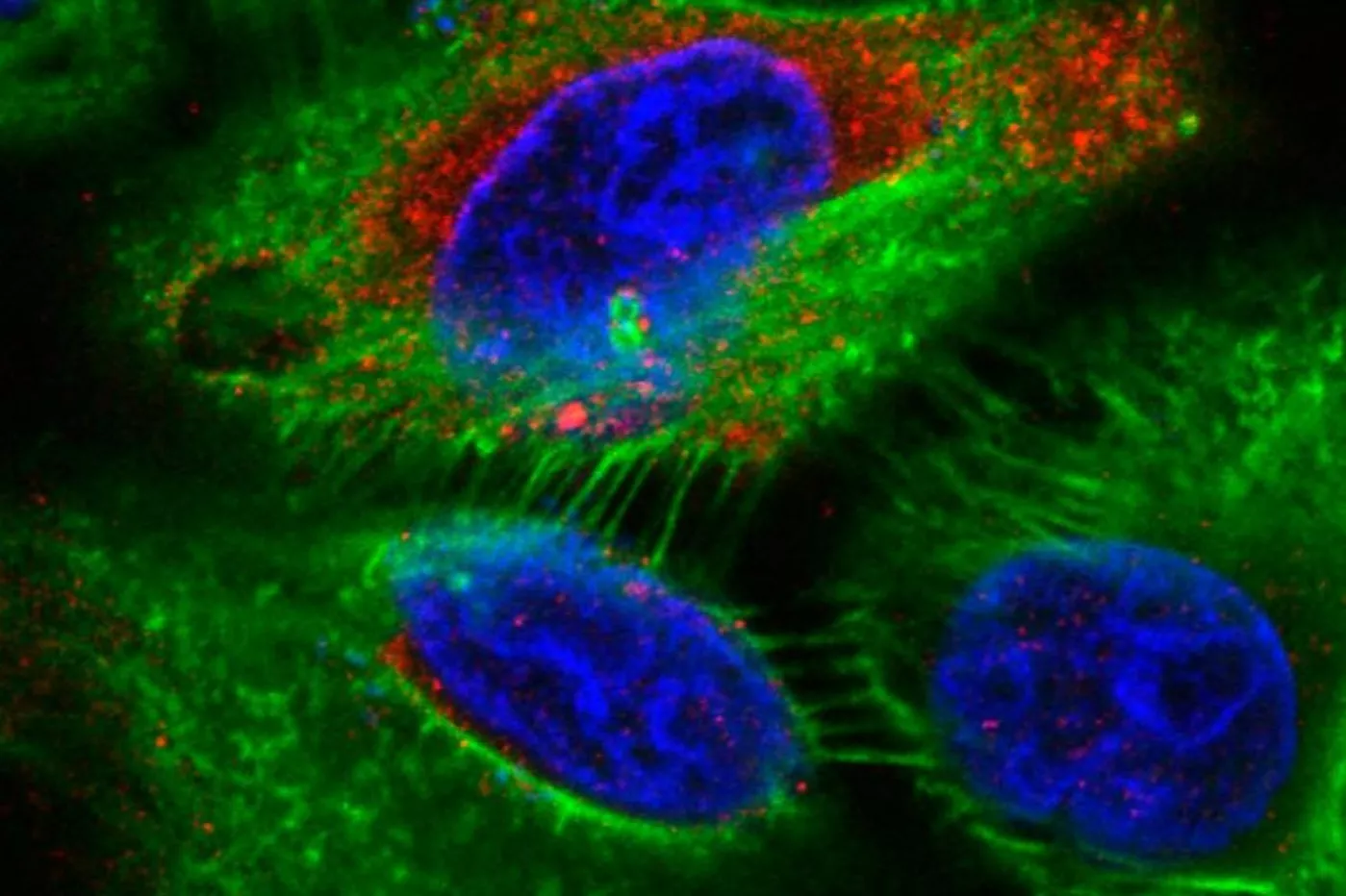 Células epiteliales humanas infectadas por E. coli.