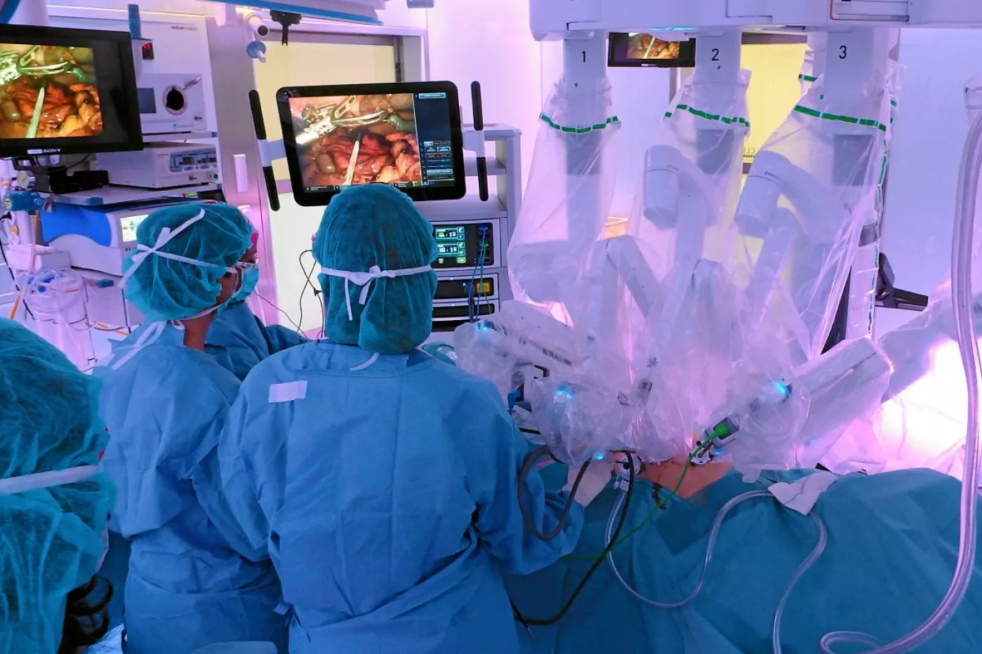 Una intervención con el robot ‘Da Vinci’ realizada por especialistas del Servicio de Cirugía Gastrointestinal del Hospital Clínico de Barcelona. (FOTO: DM).