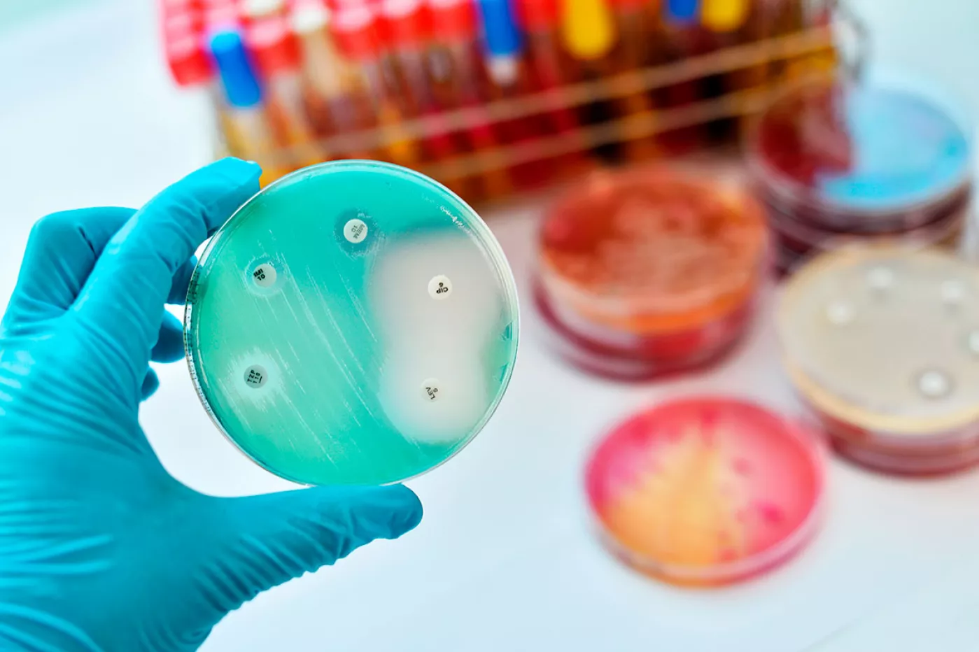 Pruebas de sensibilidad de bacterias a antibióticos (FOTO: Shutterstock). 