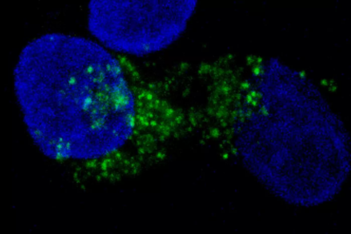 El estudio se acompaña de esta imagen: los núcleos de células tumorales en azul y en verde, los autofagosomas. Foto: UAB/ Vall d'Hebron