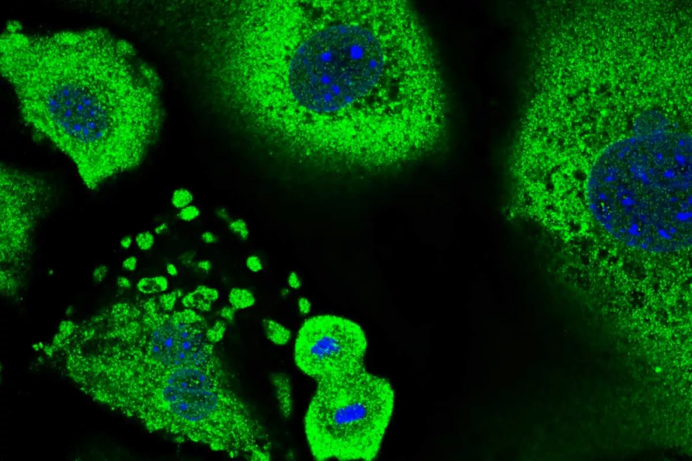 Un queratinocito sometido a la división celular rodeado de queratinocitos senescentes. Imagen: Annagiulia Ciocia / CRG