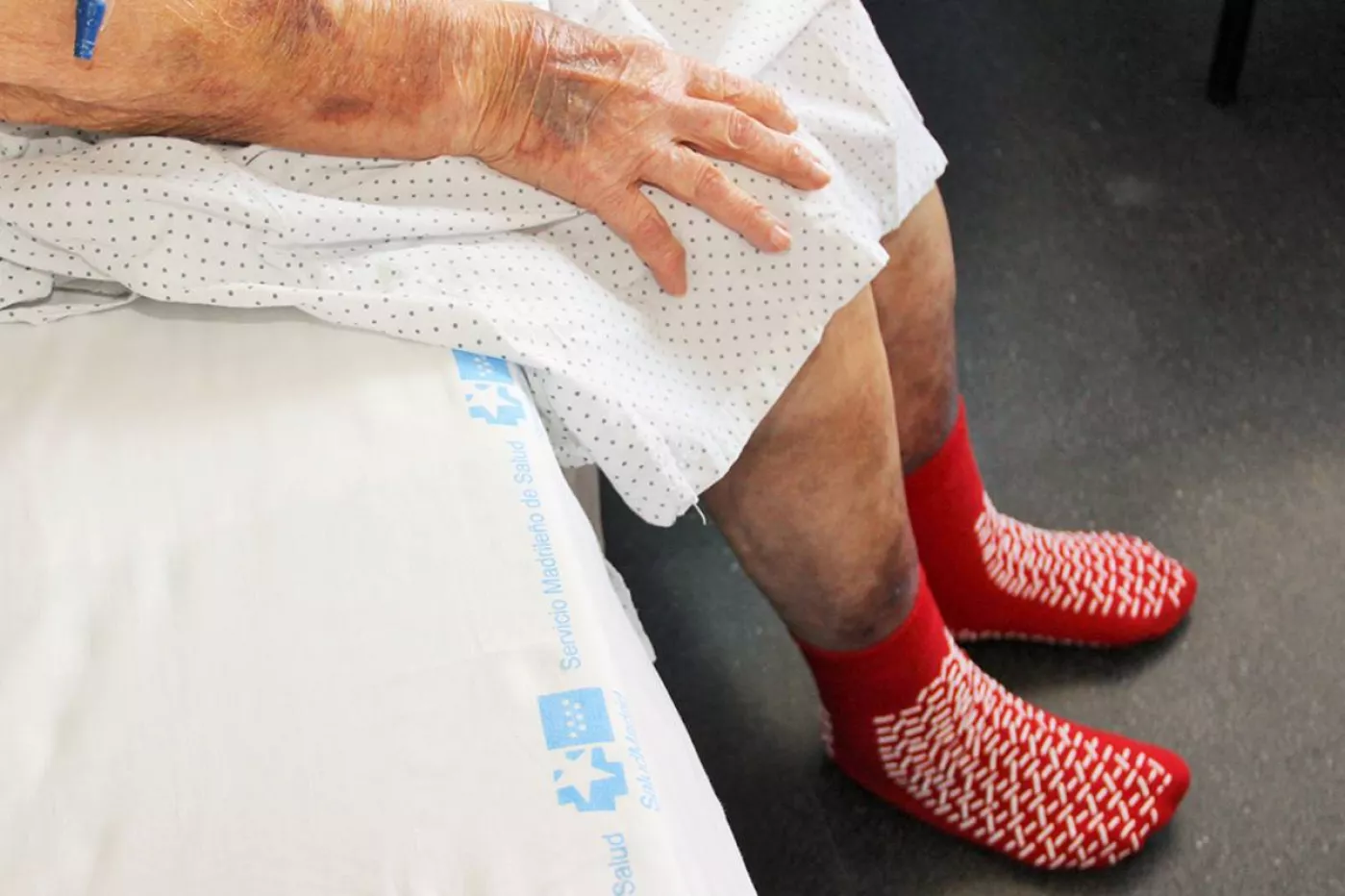 El Hospital Clínico San Carlos estudia utilizar calcetines antideslizantes para evitar caídas entre sus pacientes.