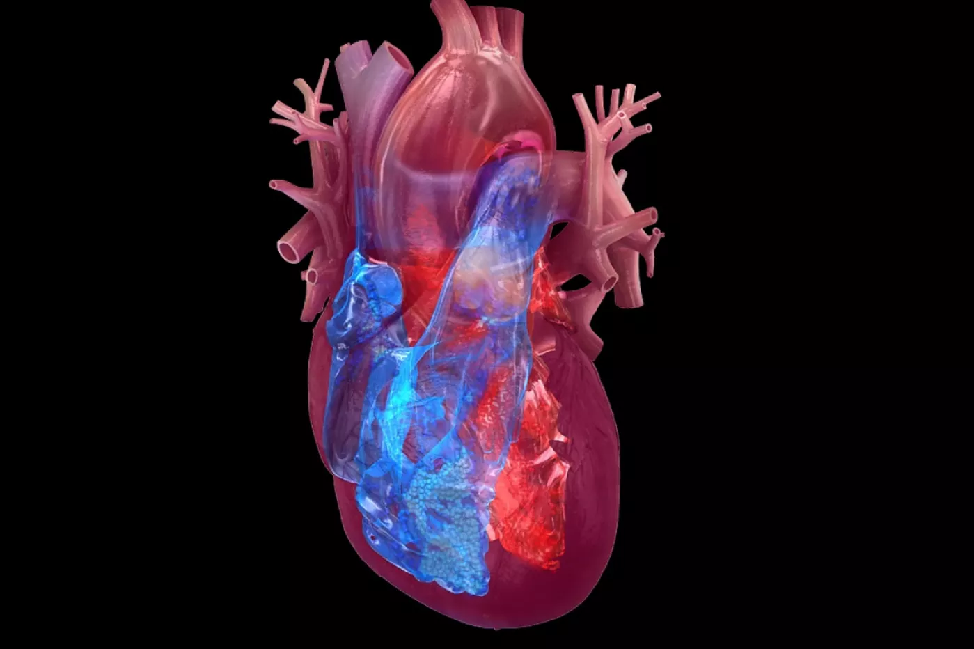 En un 80% de los niños con MIS-C, hay afectación del ventrículo izquierdo cardíaco.