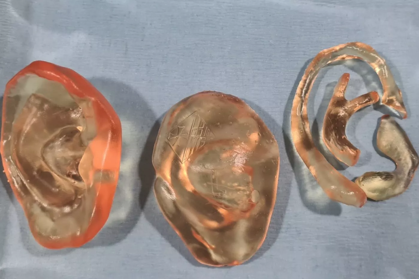 Impresión 3D de la oreja y el cartílago reconstruidos.