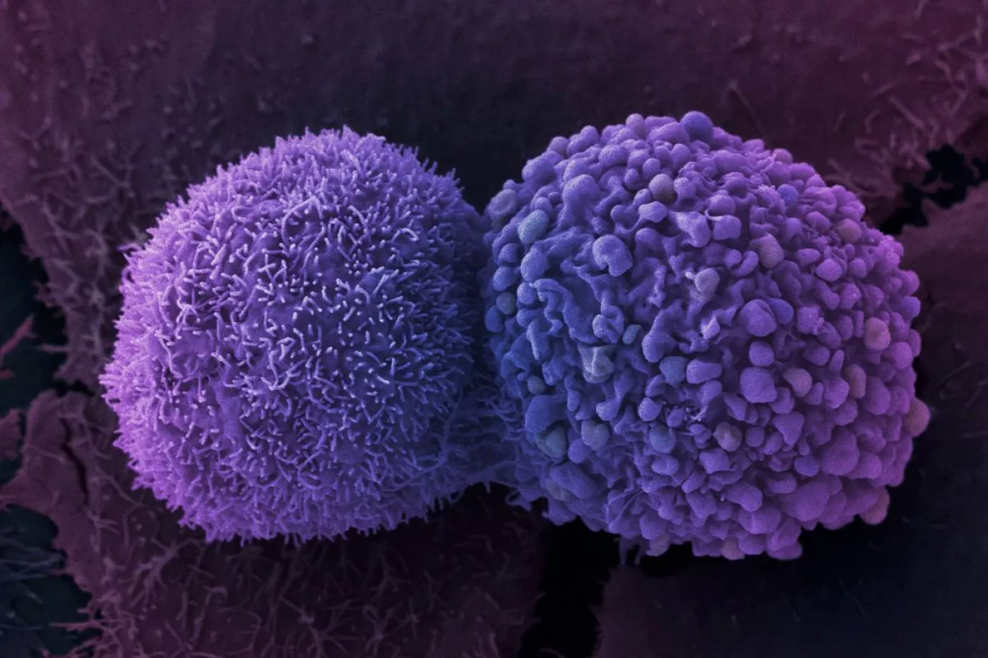 Células de cáncer de pulmón. Foto: ANNE WESTON/FRANCIS CRICK INSTITUTE