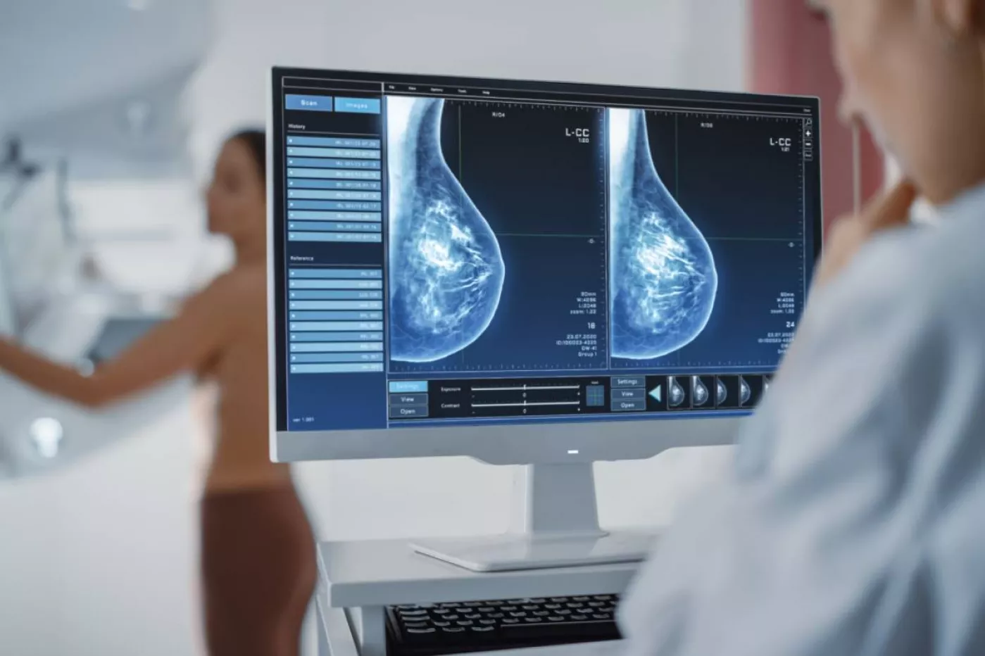 Mamografía para la detección del cáncer de mama.
