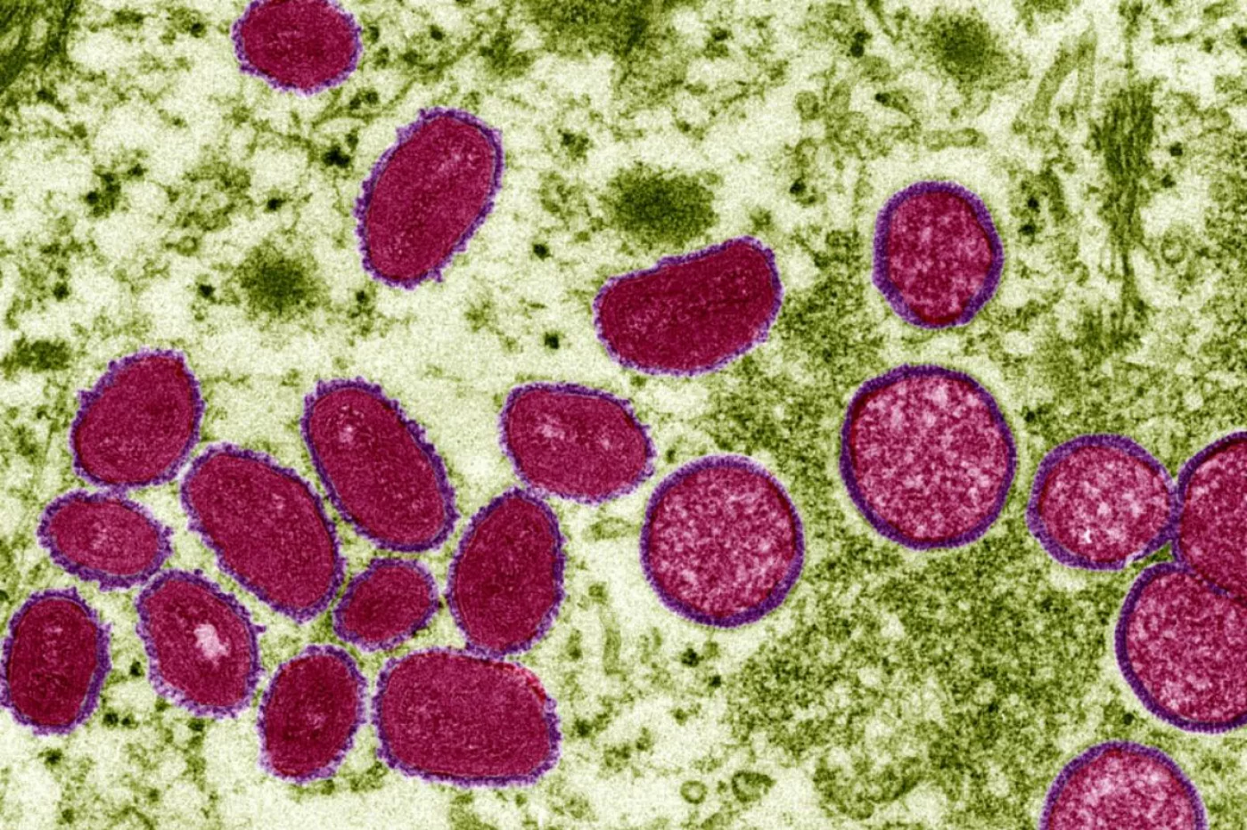 Imagen microscópica del virus de la viruela del mono. Foto: AGESPHOTOSTOCK