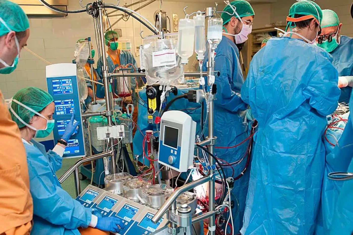 Corazón artificial total implantado en el Hospital Universitario de Bellvitge (HUB).