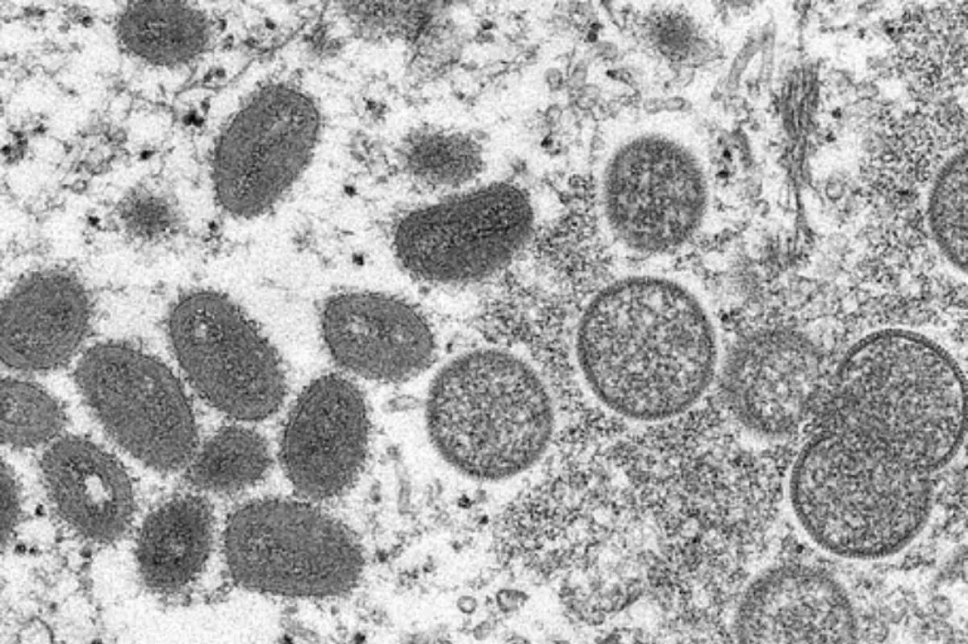 Virus a través de un microscopio electrónico. Foto: CDC