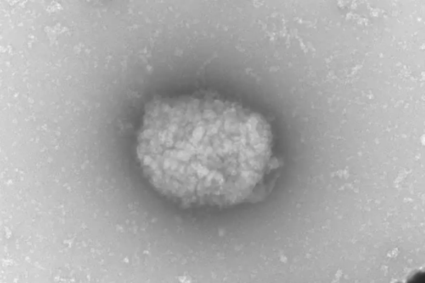 Partículas virales del virus del mono observadas por microscopia electrónica de transmisión directamente del líquido obtenido de pústulas de pacientes infectados. Foto: CSIC/UAM EFE