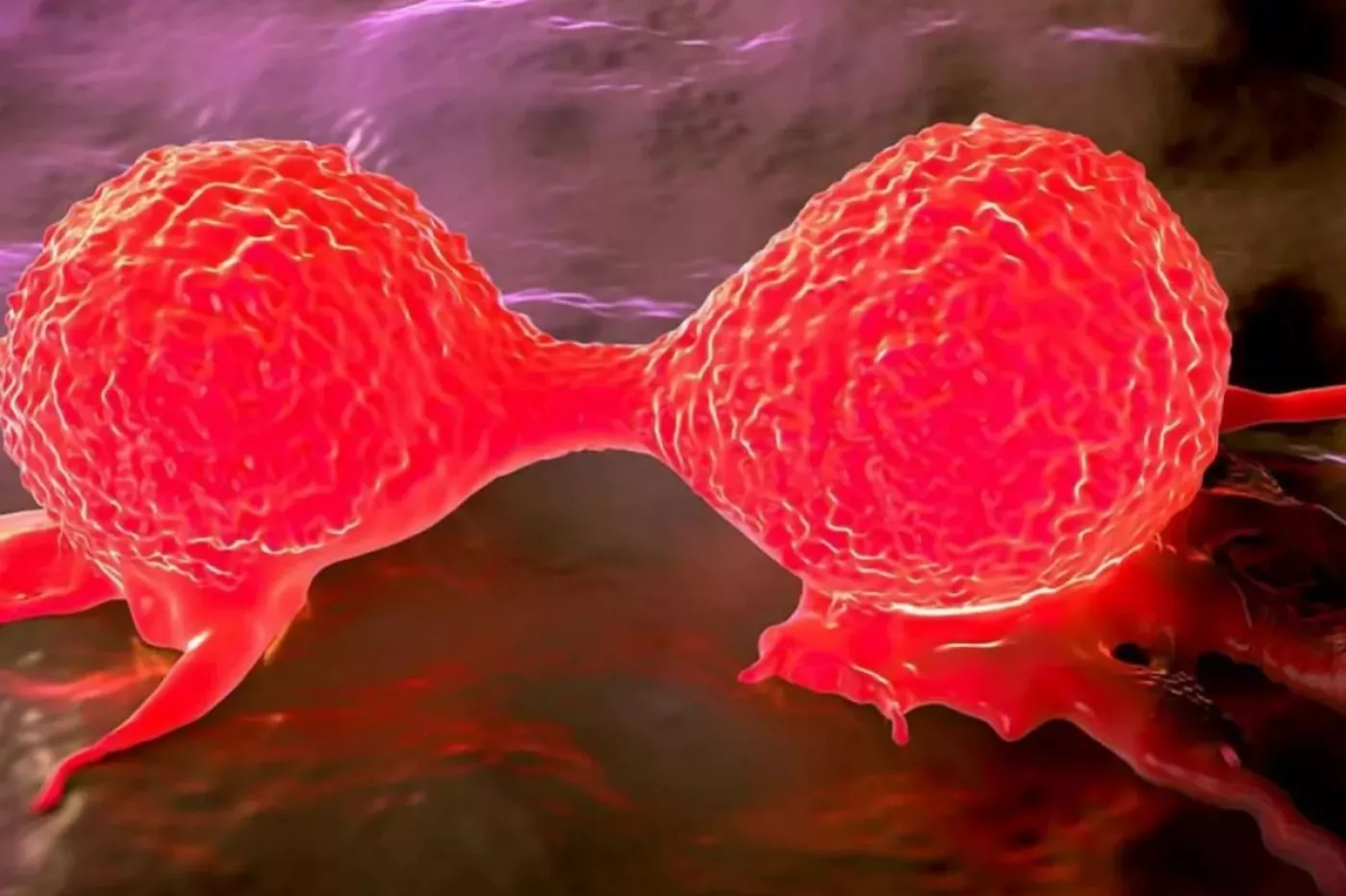 Entre el 20-25% con cáncer de mama positivo para HER2 presenta resistencias a los tratamientos. Foto: DM. 