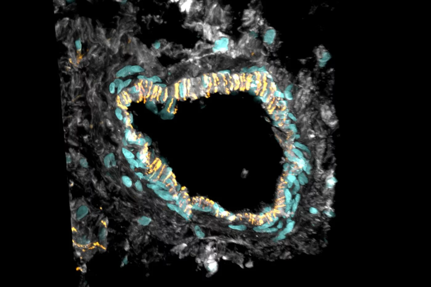 Imagen de una sección de la arteria coronaria; aparecen marcadas las células endoteliales (amarillo), las del músculo cardiaco (gris) y los núcleos celulares (azul). Foto: IMPERIAL COLLEGE LONDON.