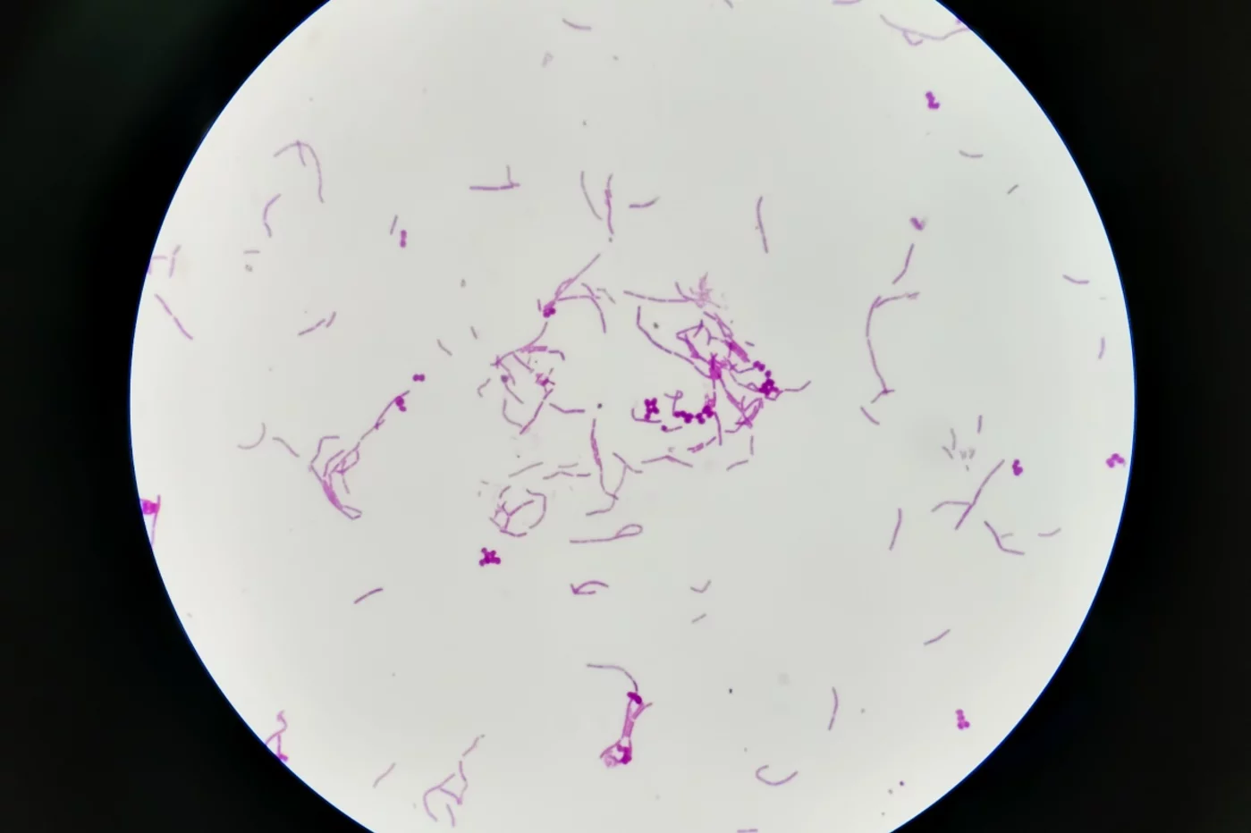Vista microscópica 100x de las bacterias gram-positivas 'Streptococcus', 'S. piogenes', 'S. agalactiae' y otros estreptococos. Foto: SHUTTERSTOCK.