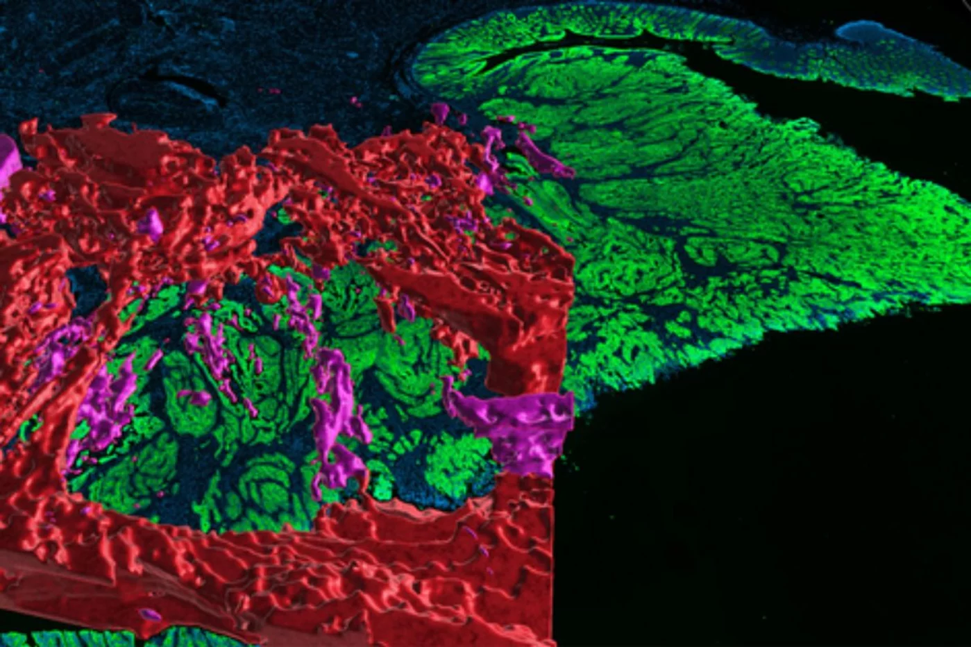 La imagen 3D muestra una red compleja y extensa de canales y cavernas (en rojo y rosa) con células cancerígenas que forman proyecciones en forma de dedos (no visibles). Imagen: CLARENCE YAPP Y SORGER. HARVARD. 