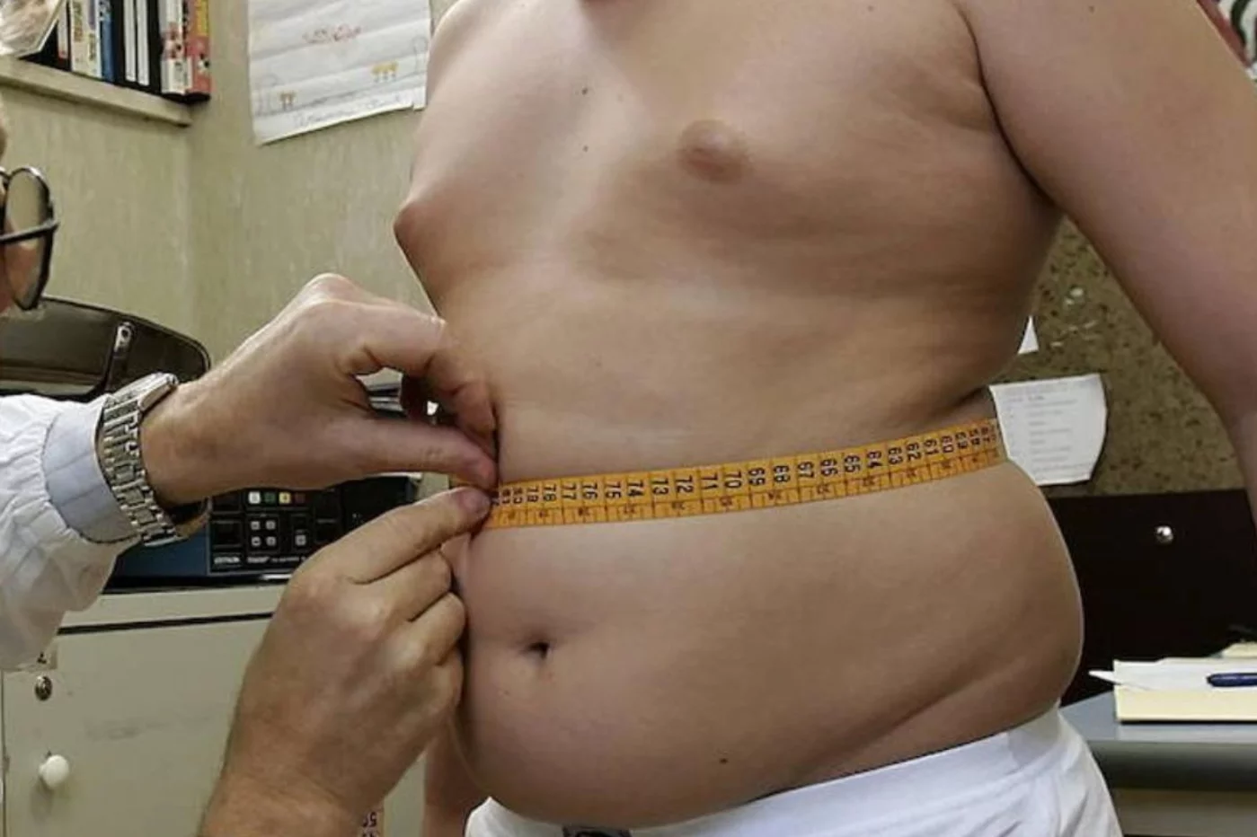 Las cifras de obesidad infantil aumentan, sobre todo en países desarrollados. Foto: DM. 