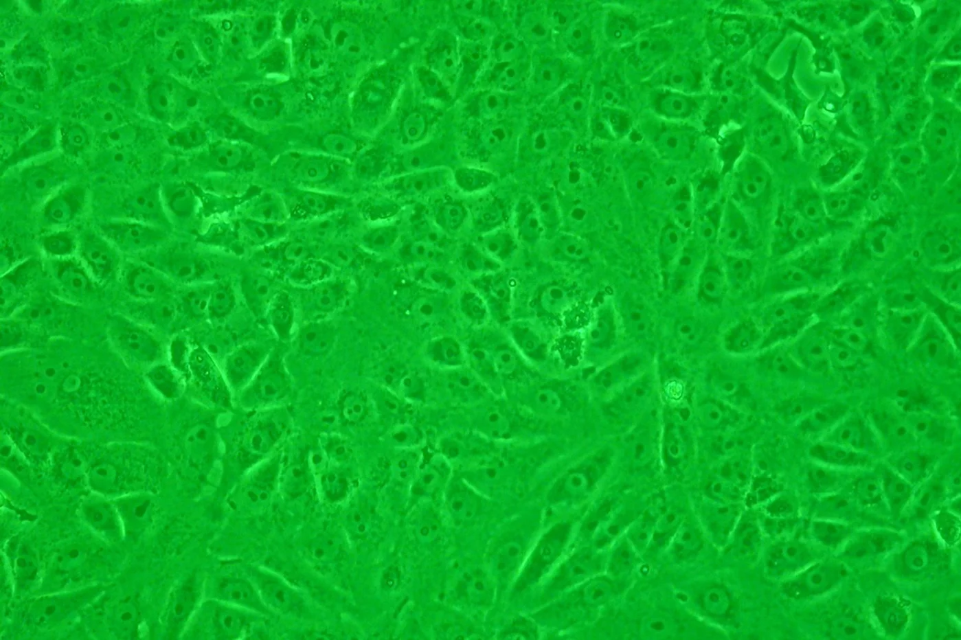 Las células Vero constituyen una de las estirpes celulares continuas de mamífero más empleadas en las investigaciones microbiológicas y de biología molecular y celular.