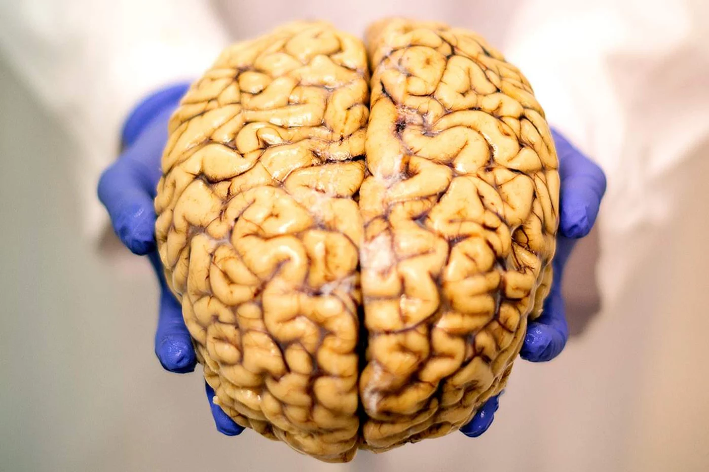 El Banco de Cerebros de la Fundación CIEN tiene más de 700 cerebros. Foto: ALBERTO DI LOLLI