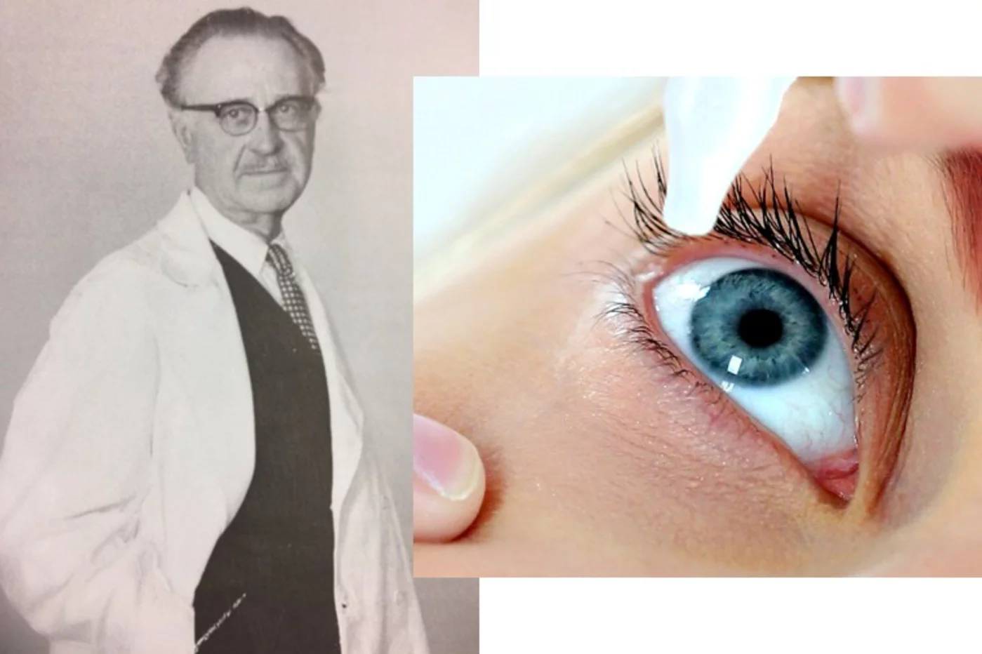 El síndrome de Sjögren toma su nombre del oculista sueco Henrik Sjögren (1899-1986).