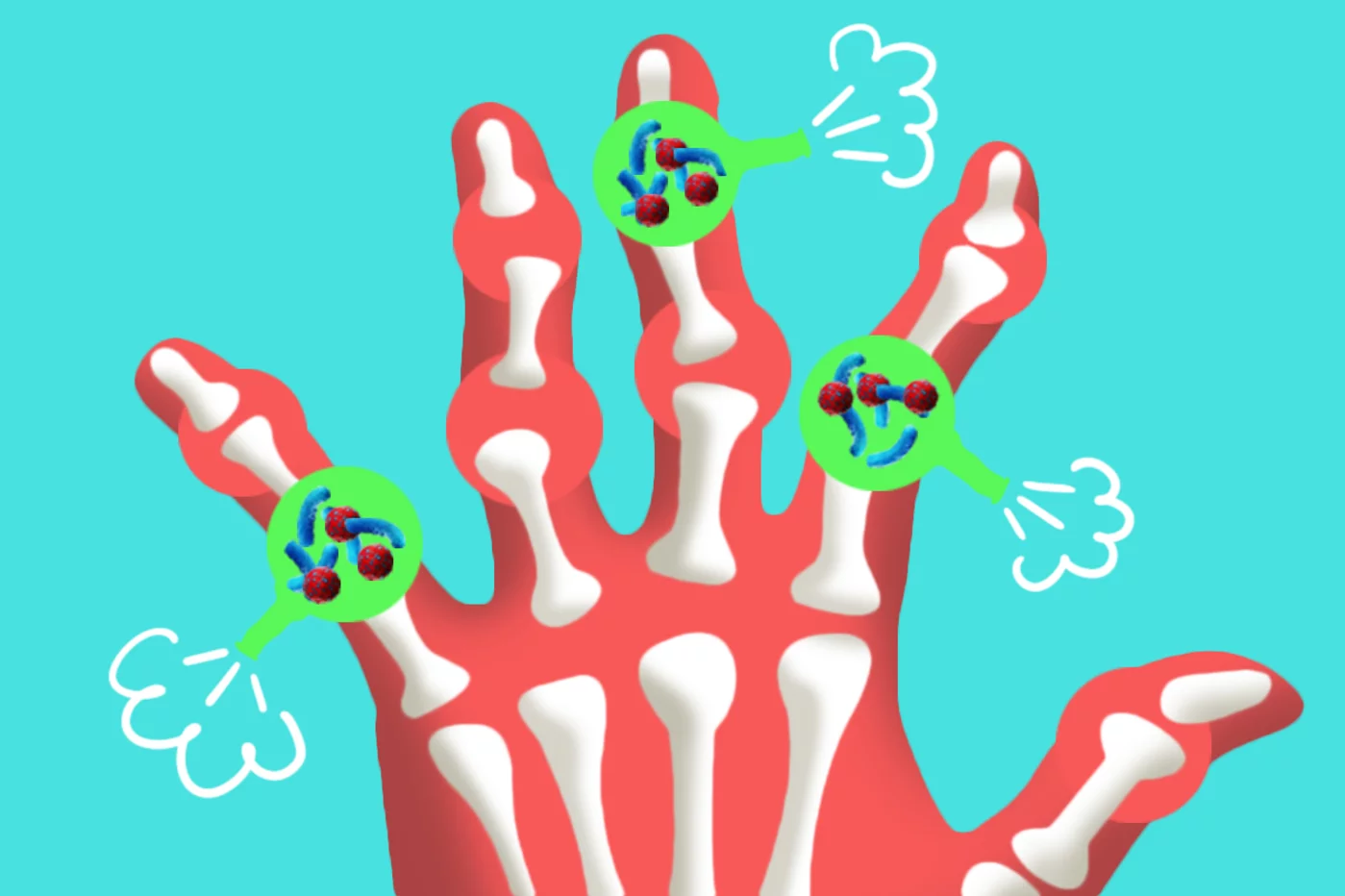 El microbioma se asocia en un metanálisis con la artritis reumatoide. Ilustración: GABRIEL SANZ.