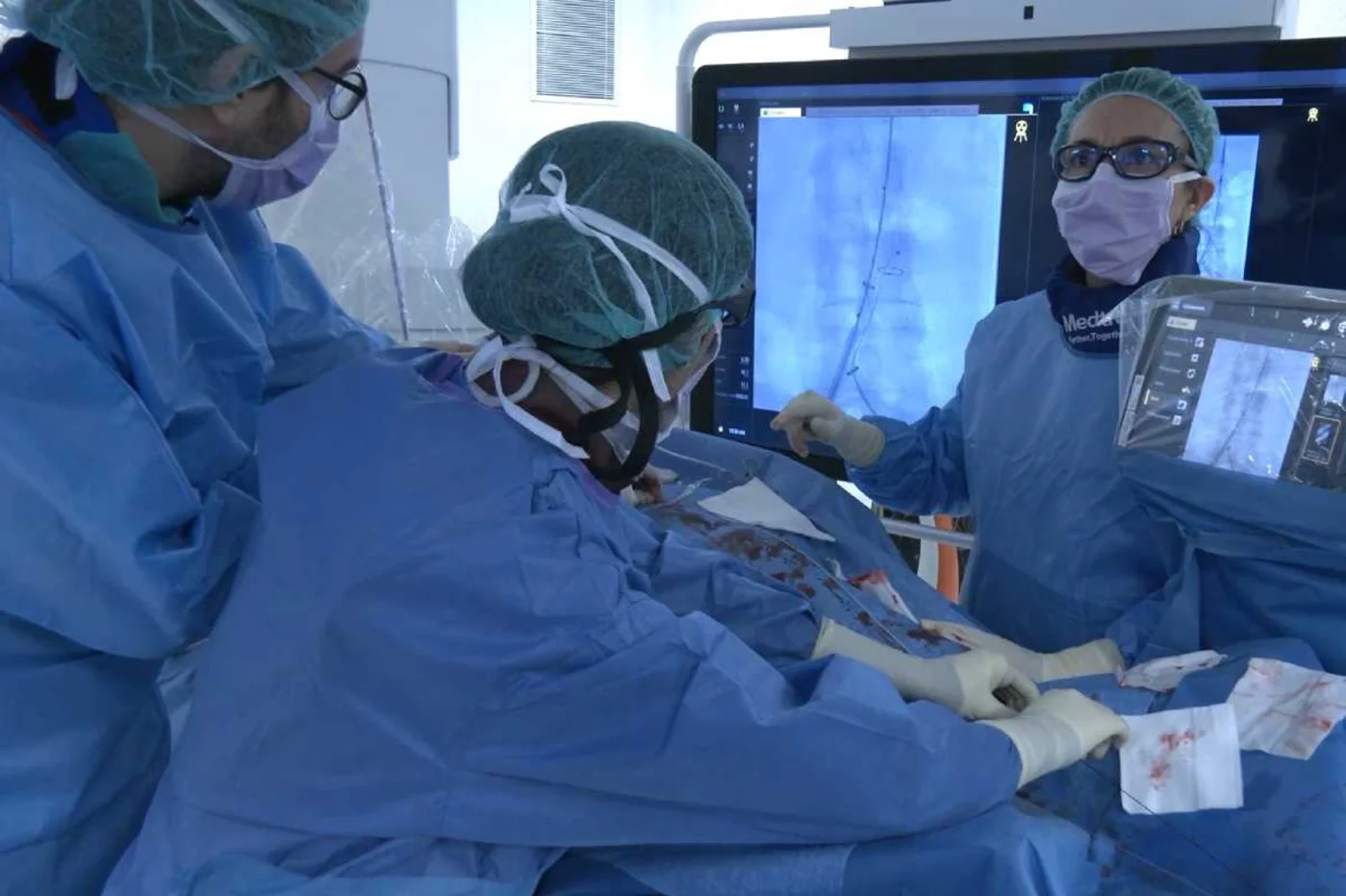 Intervención de un paciente con aneurisma de aorta abdominal con ruptura (AAAR). Foto: HOSPITAL DE BELLVITGE.