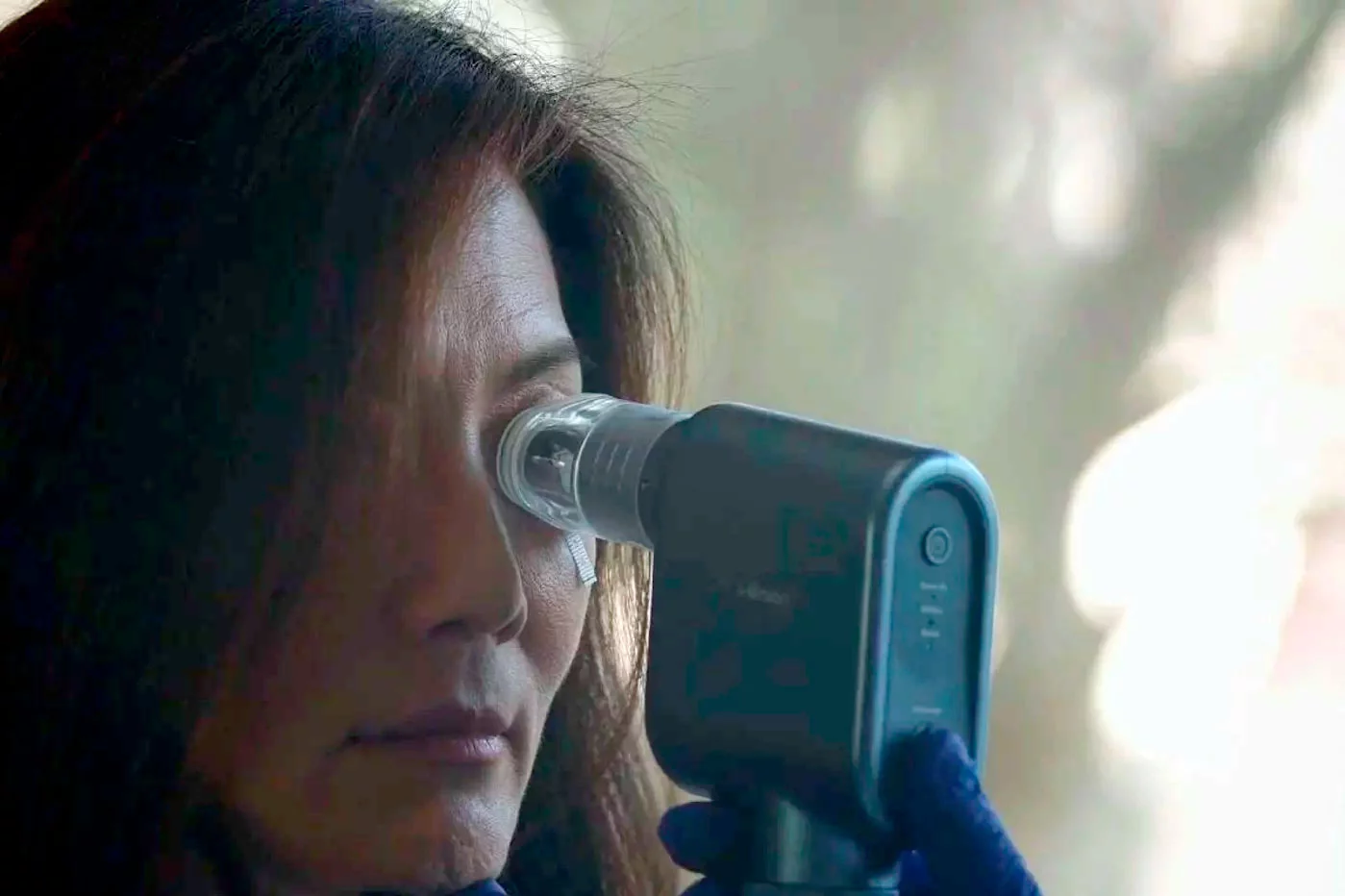 The accuracy of diagnosing dry eye with a new device called i-Onion will improve. Photo: UMH. The accuracy of diagnosing dry eye with a new device called i-Onion will improve. Photo: UMH.
