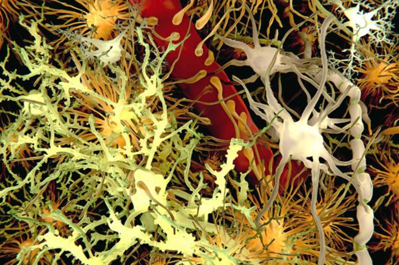 Ilustración del beta-amiloide cerebral. Los nuevos fármacos 'limpian' los depósitos de esta proteína. Ilustración del beta-amiloide cerebral. Los nuevos fármacos 'limpian' los depósitos de esta proteína.