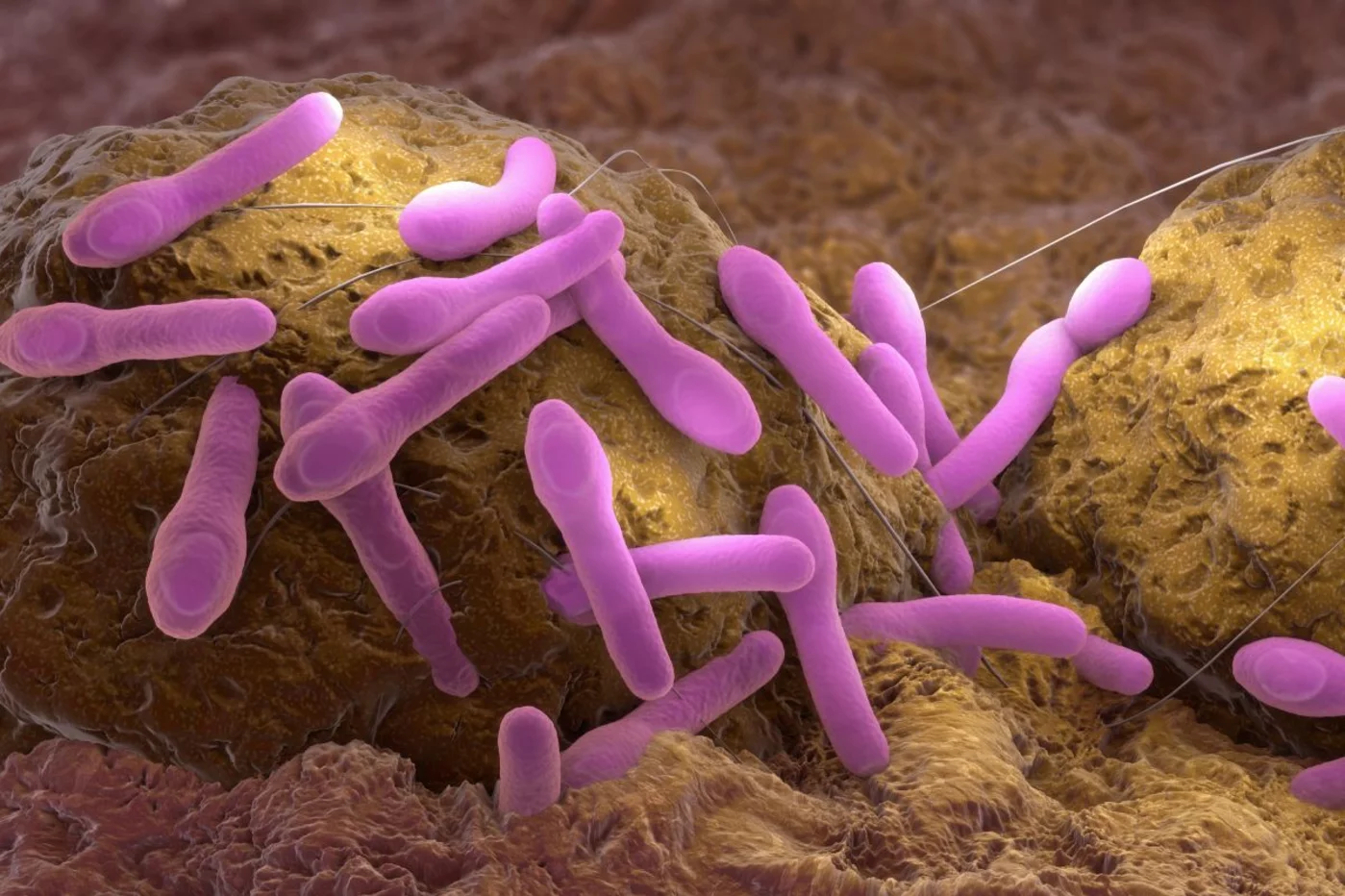 La bacteria que ocasiona el botulismo es una de las más peligrosas de las que se conocen. Foto: SHUTTERSTOCK. 