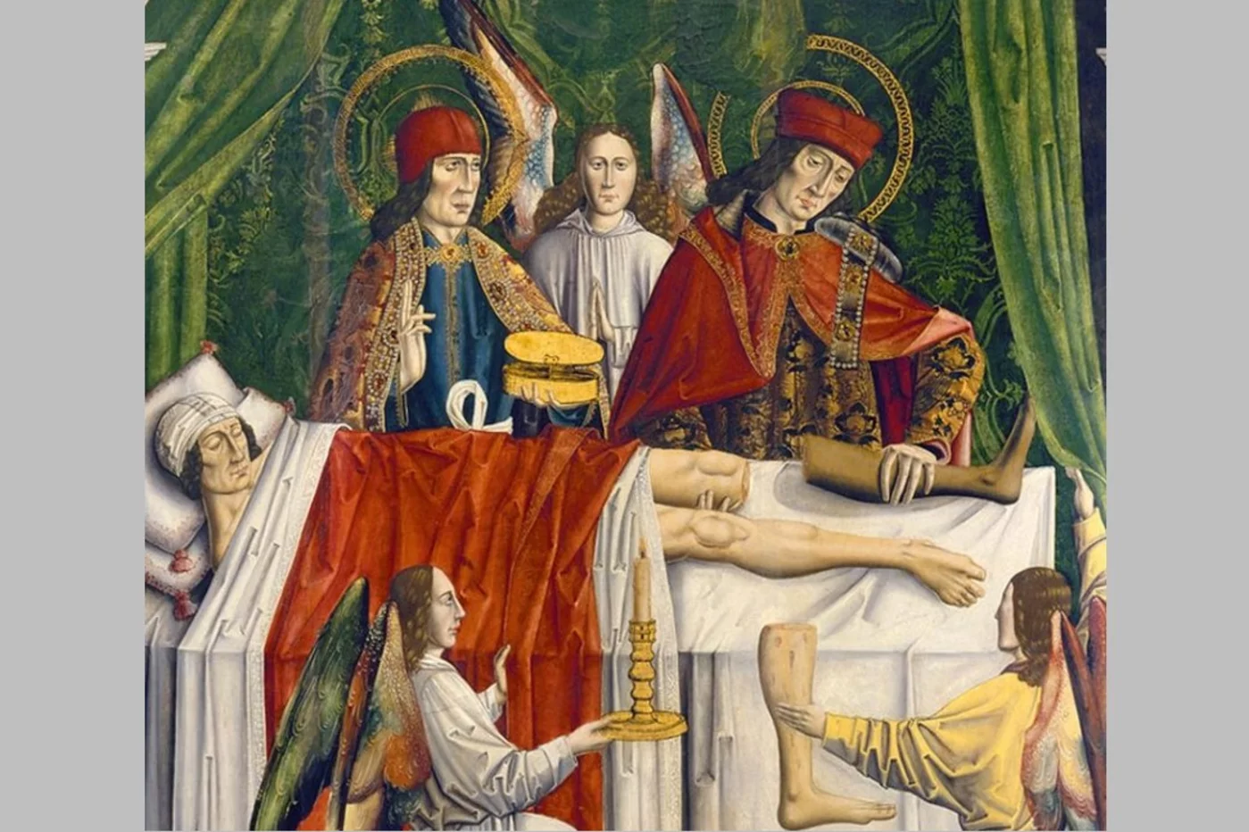 Los santos médicos Cosme y Damián en plena intervención quirúrgica de trasplante de pierna.