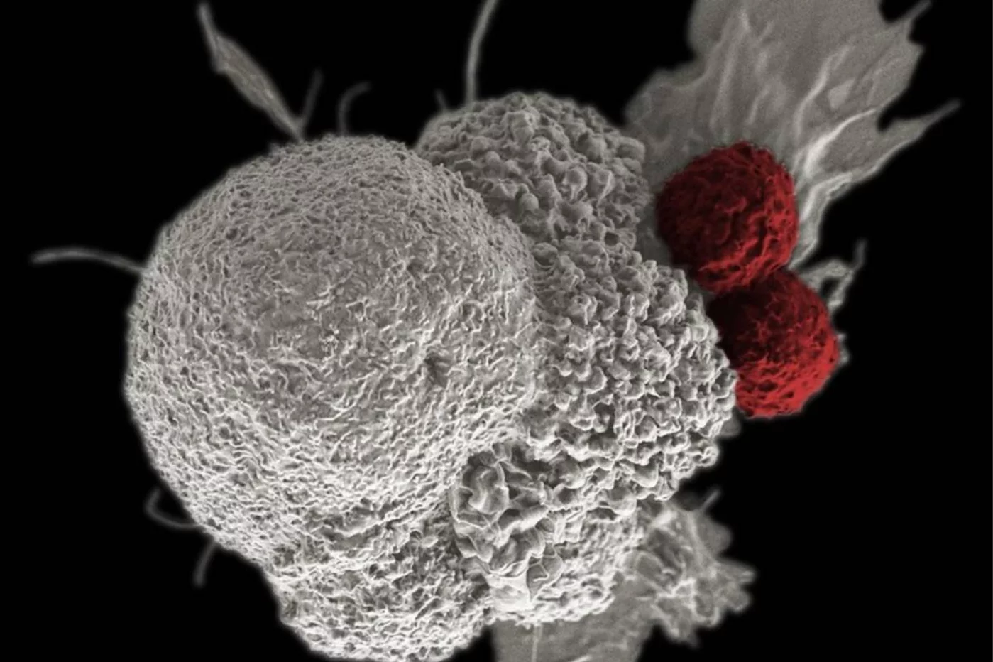 Células T atacan a células tumorales. Imagen: RITA ELENA SERDA (Duncan Comprehensive Cancer Center at Baylor College of Medicine, National Cancer Institute, National Institutes of Health).