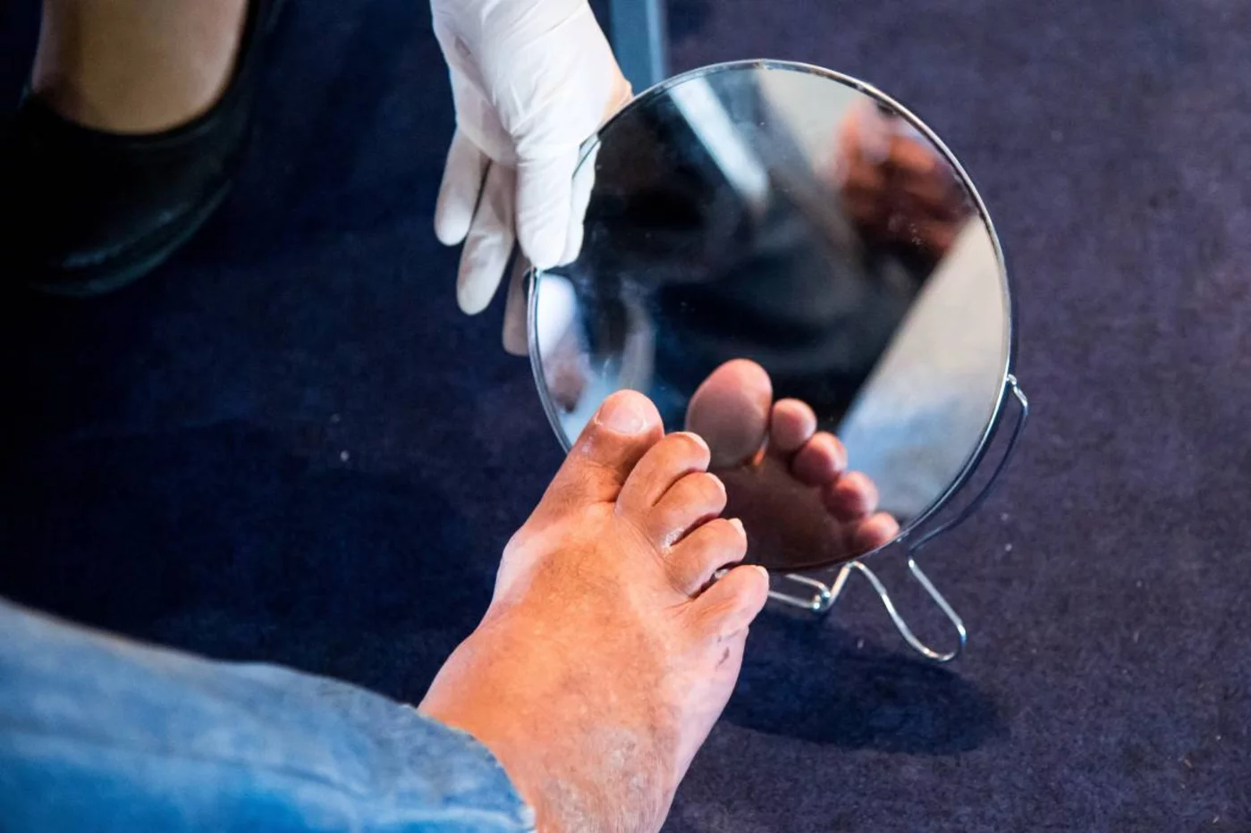 La autoexploración del pie en busca de lesiones es un hábito imprescindible de la persona con diabetes. Foto: SHUTTERSTOCK.