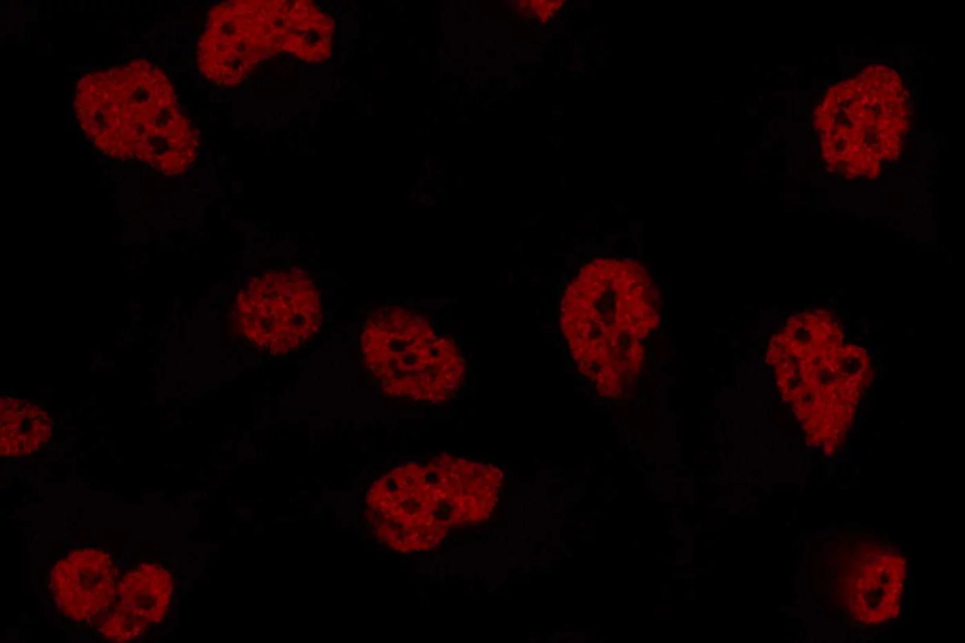 Tinción nuclear de células de cáncer de mama triple negativo. Imagen: LAURA PASCUAL/CRG.