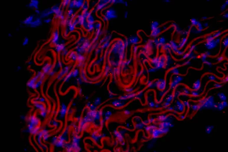 Imagen microscópica de secciones finas de aorta torácica de ratón expuesta a sondas fluorescentes para teñir los telómeros. El núcleo de las células está teñido de azul y los telómeros se observan con puntos rojos dentro del núcleo. La intensidad de la fluorescencia se correlaciona con la longitud del telómero. Las líneas rojas curvadas son de eslastina autofluorescente.